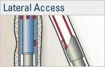 Lateral Access